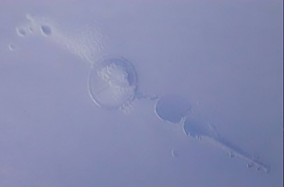 360-1-困气：注塑时带入空气